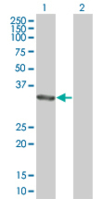Lane 1: PDLIM3 transfected lysate (34.87 KDa). Lane 2: Non-transfected lysate.