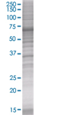 PDLIM3 transfected lysate