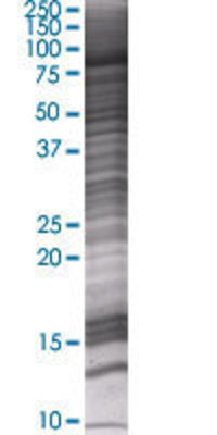 WHSC1 transfected lysate.
