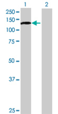 Lane 1: DIS3 transfected lysate (105.49 KDa) Lane 2: Non-transfected lysate.