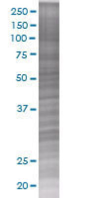 FGFR1OP transfected lysate.