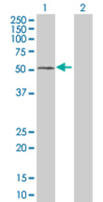Lane 1: FGFR1OP transfected lysate (43.1 KDa) Lane 2: Non-transfected lysate.