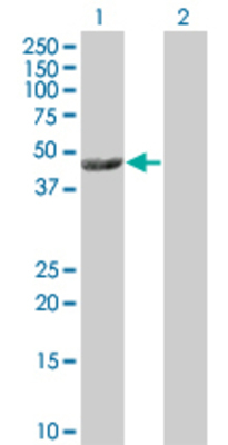 Lane 1: FLJ30934 transfected lysate (46.4 KDa) Lane 2: Non-transfected lysate.