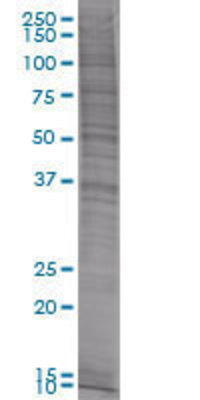 ING2 transfected lysate