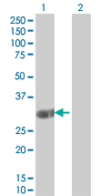 Lane 1: ING2 transfected lysate (30.91 KDa). Lane 2: Non-transfected lysate.