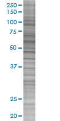 ARIH2 transfected lysate.