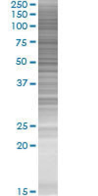 KCNQ2 transfected lysate.