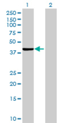 Lane 1: GNA12 transfected lysate (42.02 KDa) Lane 2: Non-transfected lysate.