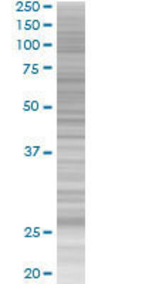 FHL5 transfected lysate.