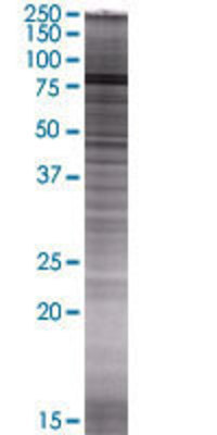 UTP3 transfected lysate.