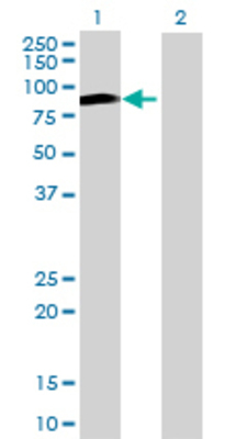 Lane 1: UTP3 transfected lysate (52.8 KDa) Lane 2: Non-transfected lysate.