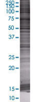 EIF4E2 transfected lysate.