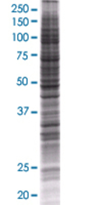 C1QTNF1 transfected lysate.