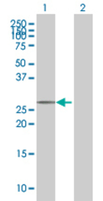 Lane 1: C1QTNF1 transfected lysate (31.02 KDa) Lane 2: Non-transfected lysate.