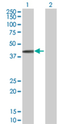 Lane 1: SPHK1 transfected lysate (43.9 KDa) Lane 2: Non-transfected lysate.