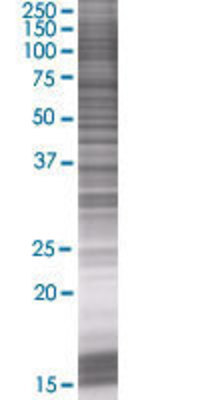 DDAH1 transfected lysate.