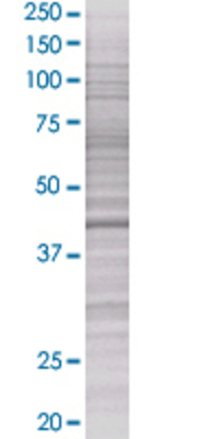 SPHK1 transfected lysate.