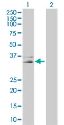 Lane 1: DCN transfected lysate (39.7 KDa) Lane 2: Non-transfected lysate.