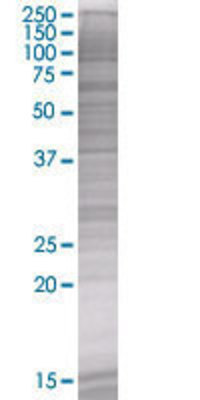 DCN transfected lysate.