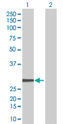 Lane 1: ING5 transfected lysate (27.8 KDa) Lane 2: Non-transfected lysate.