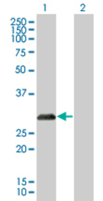 Lane 1: CDKN1B transfected lysate (22.1 KDa) Lane 2: Non-transfected lysate.