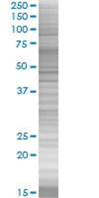 KLK13 transfected lysate.