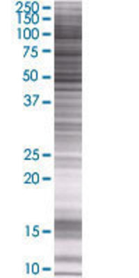 GAL3ST4 transfected lysate.