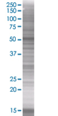 CFLAR transfected lysate.