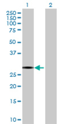Lane 1: CCS transfected lysate (30.25 KDa) Lane 2: Non-transfected lysate.