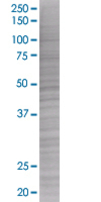 TNFRSF10B transfected lysate