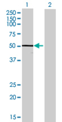 Lane 1: CPM transfected lysate (48.84 KDa) Lane 2: Non-transfected lysate.