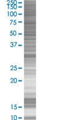 SSX5 transfected lysate.
