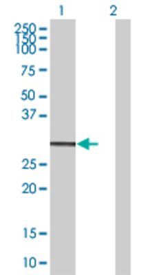 Lane 1: SSX5 transfected lysate (25.3 KDa) Lane 2: Non-transfected lysate.