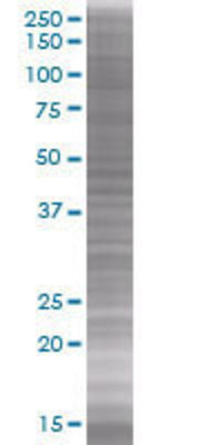 CDK6 transfected lysate
