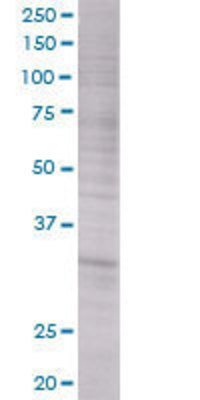 PRKRA transfected lysate.