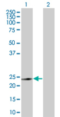 Lane 1: CACYBP transfected lysate (25.19 KDa) Lane 2: Non-transfected lysate.