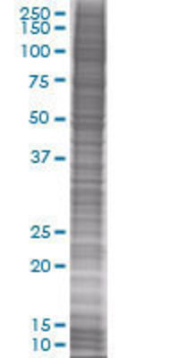 RNF144 transfected lysate