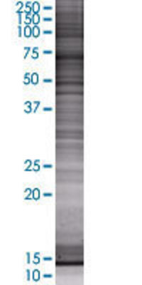 TBX22 transfected lysate.