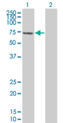 Lane 1: RDX transfected lysate (64.24 KDa) Lane 2: Non-transfected lysate.