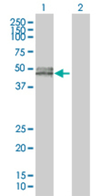 Lane 1: CD14 transfected lysate (40.1 KDa). Lane 2: Non-transfected lysate.