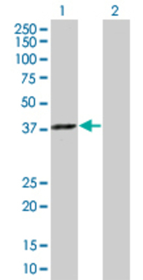 Lane 1: GTF2B transfected lysate (34.87 KDa) Lane 2: Non-transfected lysate.