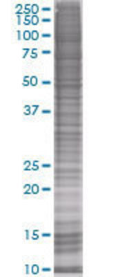 KCNIP1 transfected lysate