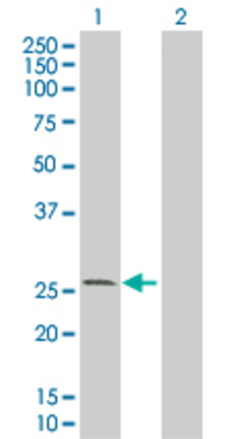 Lane 1: KCNIP1 transfected lysate (23.87 KDa). Lane 2: Non-transfected lysate.
