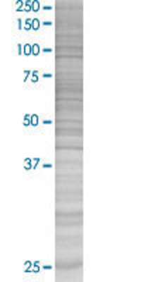 PSPH transfected lysate.