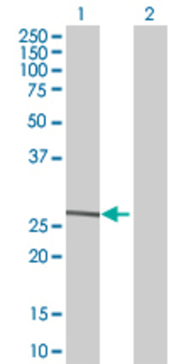 Lane 1: PSPH transfected lysate (24.86 KDa) Lane 2: Non-transfected lysate.