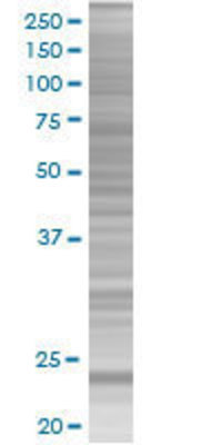 SRY transfected lysate.