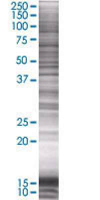 ABTB1 transfected lysate.
