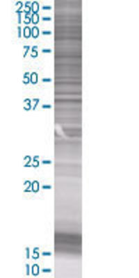 NME7 transfected lysate.