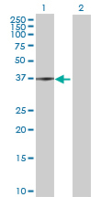 Lane 1: ACAD8 transfected lysate (45.76 KDa) Lane 2: Non-transfected lysate.