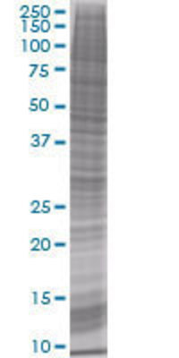 SSX2 transfected lysate